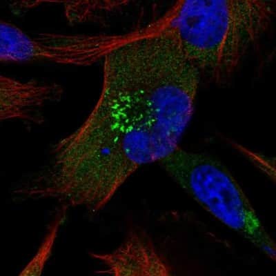 Immunocytochemistry/ Immunofluorescence: ABCB6 Antibody [NBP1-91642]