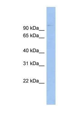 Western Blot: ABCB6 Antibody [NBP1-57029]