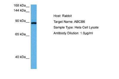 Western Blot: ABCB6 Antibody [NBP3-10799]