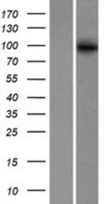 Western Blot: ABCB6 Overexpression Lysate [NBP2-07717]