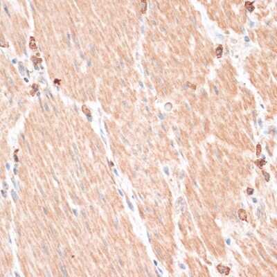 Immunohistochemistry-Paraffin: ABCB7 Antibody - Azide and BSA Free [NBP2-92864]