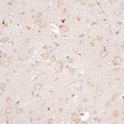Immunohistochemistry-Paraffin: ABCB7 Antibody - Azide and BSA Free [NBP2-92864]