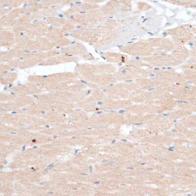 Immunohistochemistry-Paraffin: ABCB7 Antibody - Azide and BSA Free [NBP2-92864]