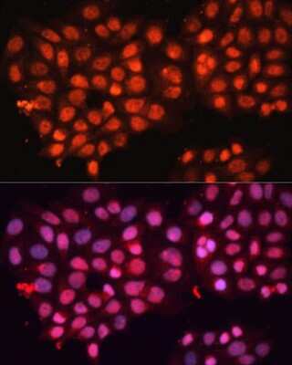 Immunocytochemistry/ Immunofluorescence: ABCB8 Antibody - BSA Free [NBP2-92883]
