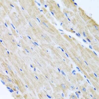 Immunohistochemistry-Paraffin: ABCB8 Antibody - BSA Free [NBP2-92883]