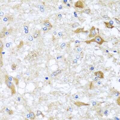 Immunohistochemistry-Paraffin: ABCB8 Antibody - BSA Free [NBP2-92883]