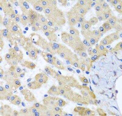 Immunohistochemistry-Paraffin: ABCB8 Antibody - BSA Free [NBP2-92883]