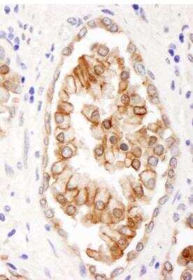 Immunohistochemistry-Paraffin: ABCB9 Antibody [NBP1-18886]