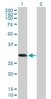 Western Blot: ABCC10 Antibody [H00089845-B01P]