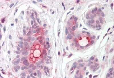 Immunohistochemistry-Paraffin: ABCC11 Antibody [NBP1-20944]