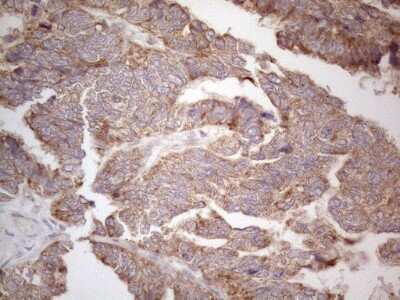 Immunohistochemistry: ABCC5 Antibody (OTI2C8) [NBP2-46467]