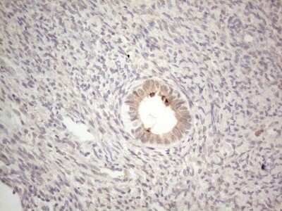 Immunohistochemistry: ABCC5 Antibody (OTI2C8) [NBP2-46467]