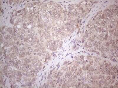 Immunohistochemistry: ABCC5 Antibody (OTI2C8) [NBP2-46467]