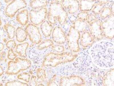 Immunohistochemistry-Paraffin: ABCC5 Antibody [NB100-94881]
