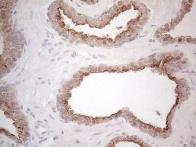 Immunohistochemistry: ABCC5 Antibody (OTI2C8) - Azide and BSA Free [NBP2-71540]