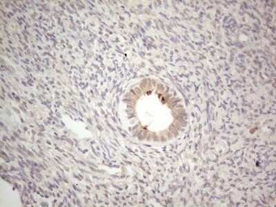 Immunohistochemistry: ABCC5 Antibody (OTI2C8) - Azide and BSA Free [NBP2-71540]