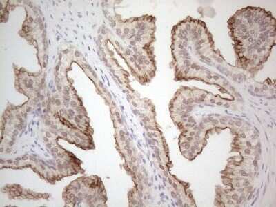 Immunohistochemistry: ABCC5 Antibody (OTI2C8) - Azide and BSA Free [NBP2-71540]