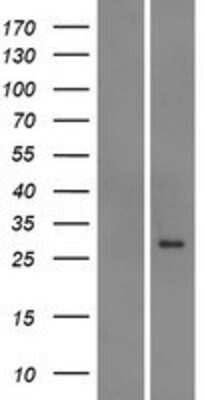 Western Blot: ABCC5 Overexpression Lysate [NBP2-08652]