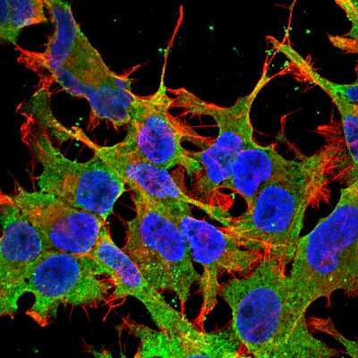 Immunocytochemistry/ Immunofluorescence: ABCC9 Antibody (S319A-14) [NBP2-22403]