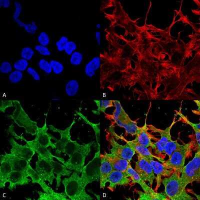 Immunocytochemistry/ Immunofluorescence: ABCC9 Antibody (S319A-14) [NBP2-22403]