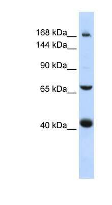 Western Blot: ABCC9 Antibody [NBP1-59350]