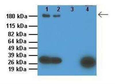 Western Blot: ABCC9 Antibody [NBP1-59350]