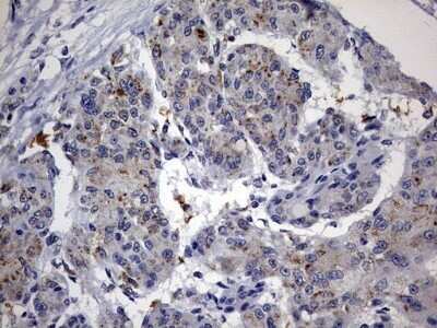 Immunohistochemistry: ABCD1 Antibody (OTI2C12) - Azide and BSA Free [NBP2-70150]