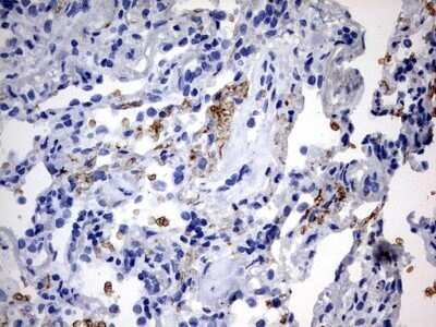 Immunohistochemistry: ABCD1 Antibody (OTI2C12) - Azide and BSA Free [NBP2-70150]