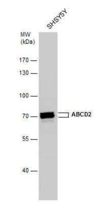 Western Blot: ABCD2 Antibody [NBP1-33435]