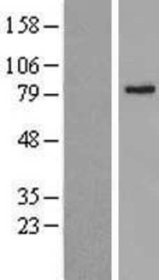 Western Blot: ABCD2 Overexpression Lysate [NBL1-07180]