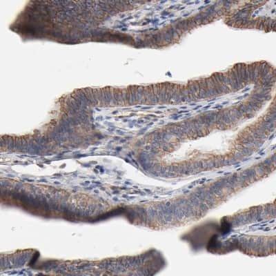 Immunohistochemistry-Paraffin: ABCD4 Antibody [NBP1-83954]