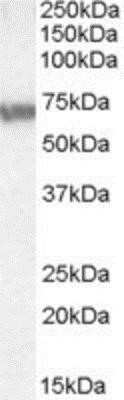 Western Blot: ABCD4 Antibody [NBP1-20872]