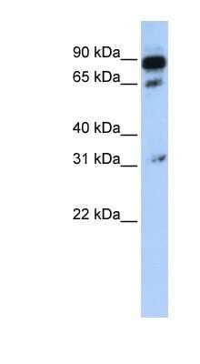 Western Blot: ABCD4 Antibody [NBP1-59397]