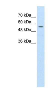 Western Blot: ABCD4 Antibody [NBP1-59807]