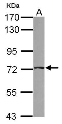 Western Blot: ABCD4 Antibody [NBP2-15224]