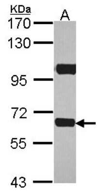 Western Blot: ABCD4 Antibody [NBP2-21601]
