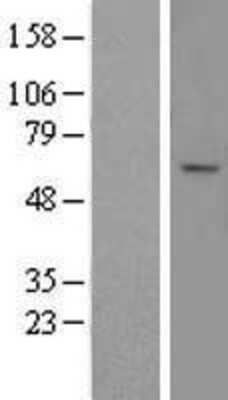 Western Blot: ABCD4 Overexpression Lysate [NBL1-07181]