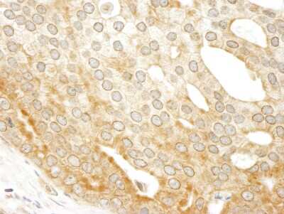 Immunohistochemistry: ABCF1 Antibody [NBP1-18889]