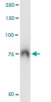 Immunoprecipitation: ABCF2 Antibody (1D11) [H00010061-M01]