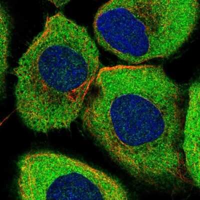 Immunocytochemistry/ Immunofluorescence: ABCF2 Antibody [NBP1-89317]