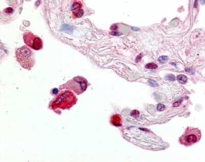 Immunohistochemistry-Paraffin: ABCG1 Antibody - BSA Free [NB400-132]