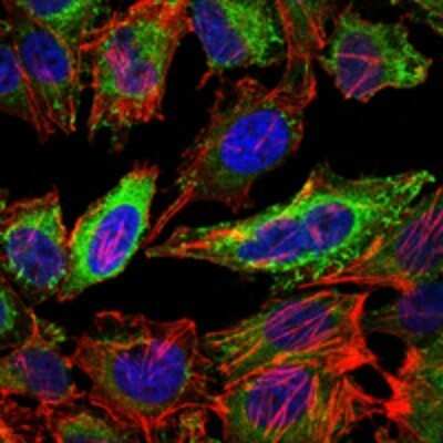Immunocytochemistry/ Immunofluorescence: ABCG2/CD338 Antibody (3G8) - Azide and BSA Free [NBP2-80558]