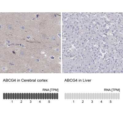 Immunohistochemistry-Paraffin: ABCG4 Antibody [NBP3-17072]