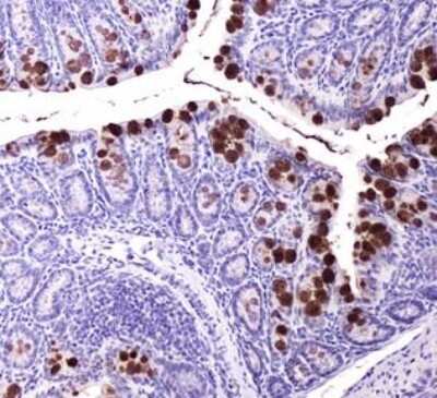 Immunohistochemistry: ABCG8 Antibody (1B10A5) - Azide and BSA Free [NBP2-80560]