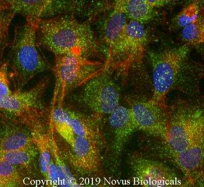 Immunocytochemistry/ Immunofluorescence: ABCG8 Antibody (1B10A5) [NBP1-71706]