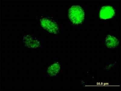 Immunocytochemistry/ Immunofluorescence: ABH1 Antibody [H00008846-B01P]