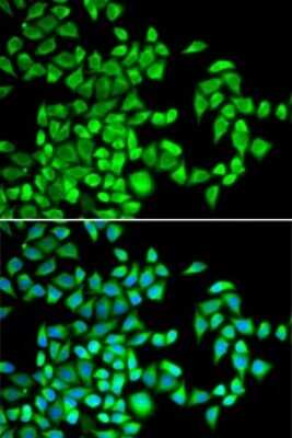 Immunocytochemistry/ Immunofluorescence: ABH1 Antibody - BSA Free [NBP2-92691]