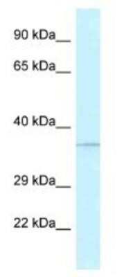 Western Blot: ABH1 Antibody [NBP1-79909]