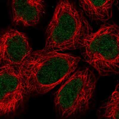 Immunocytochemistry/ Immunofluorescence: ABH2 Antibody [NBP2-55544]