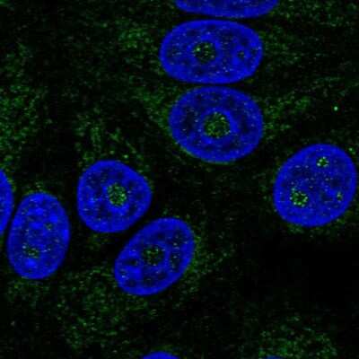 Immunocytochemistry/ Immunofluorescence: ABHD11 Antibody [NBP1-87254]